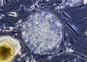 cellula staminale (embrionale)