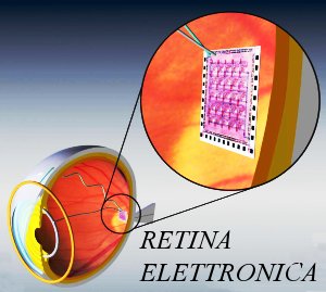retina elettronica