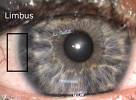 Zona oculare ricca di staminali, ossia di cellule capaci di riparare la cornea