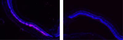 A sinistra: danno retinico (zona rosa). A destra: le nanoparticelle avrebbero protetto la retina dai danni (Credit: Image courtesy of Rajendra Kumar-Singh, Tufts University School of Medicine)