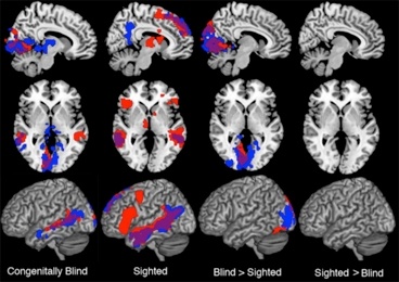 Attività del cervello a confronto. Da sinistra corteccia di un cieco congenito, di un vedente, le aree attivate in più dai ciechi e quelle attivate in più dalla corteccia dei vedenti (Fonte: MIT)