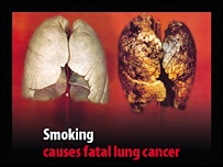 Il fumo provoca il cancro mortale ai polmoni