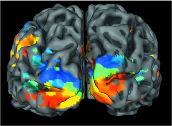 Cervello: aree della corteccia deputate alla visione (Fonte: Università di Monaco, Germania)
