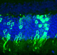 Bastoncelli nuovi in retina di topi ciechi (Foto: UCL)