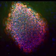 Staminali ottenute da cellule adulte geneticamente riprogrammate (iPS o pluripotenti indotte). Foto: Stephen Tsang