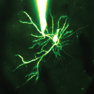 Neurone della corteccia visiva di topo al microscopio (evidenziato mediante colorante 