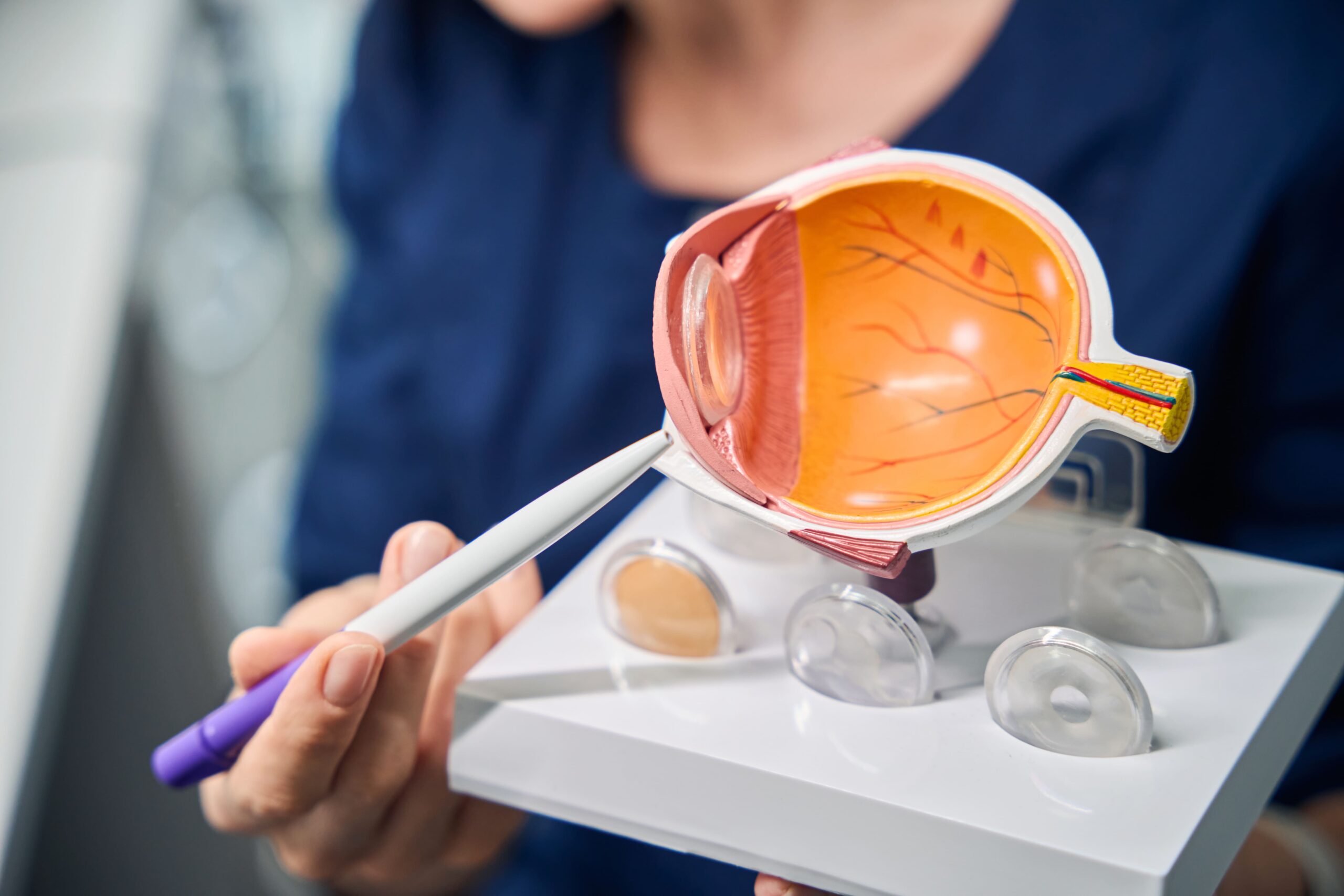 neuropatia ottica ischemica anteriore