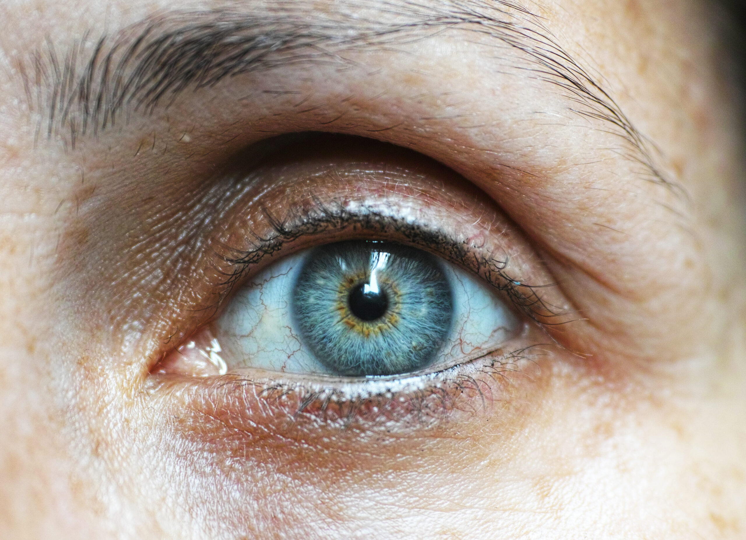 sintomi danni cornea