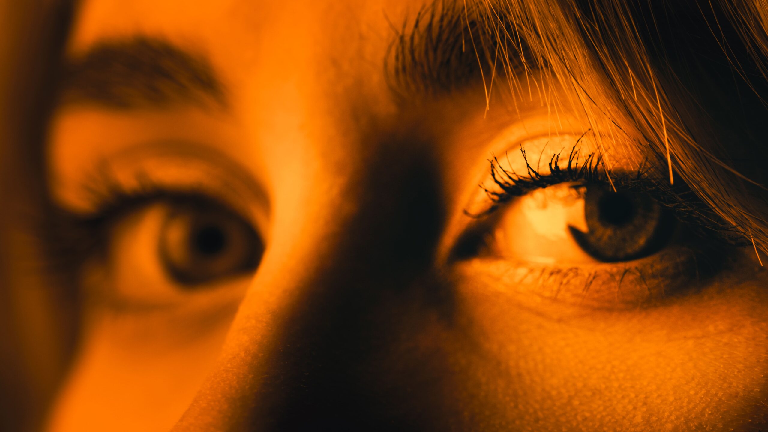 glaucoma