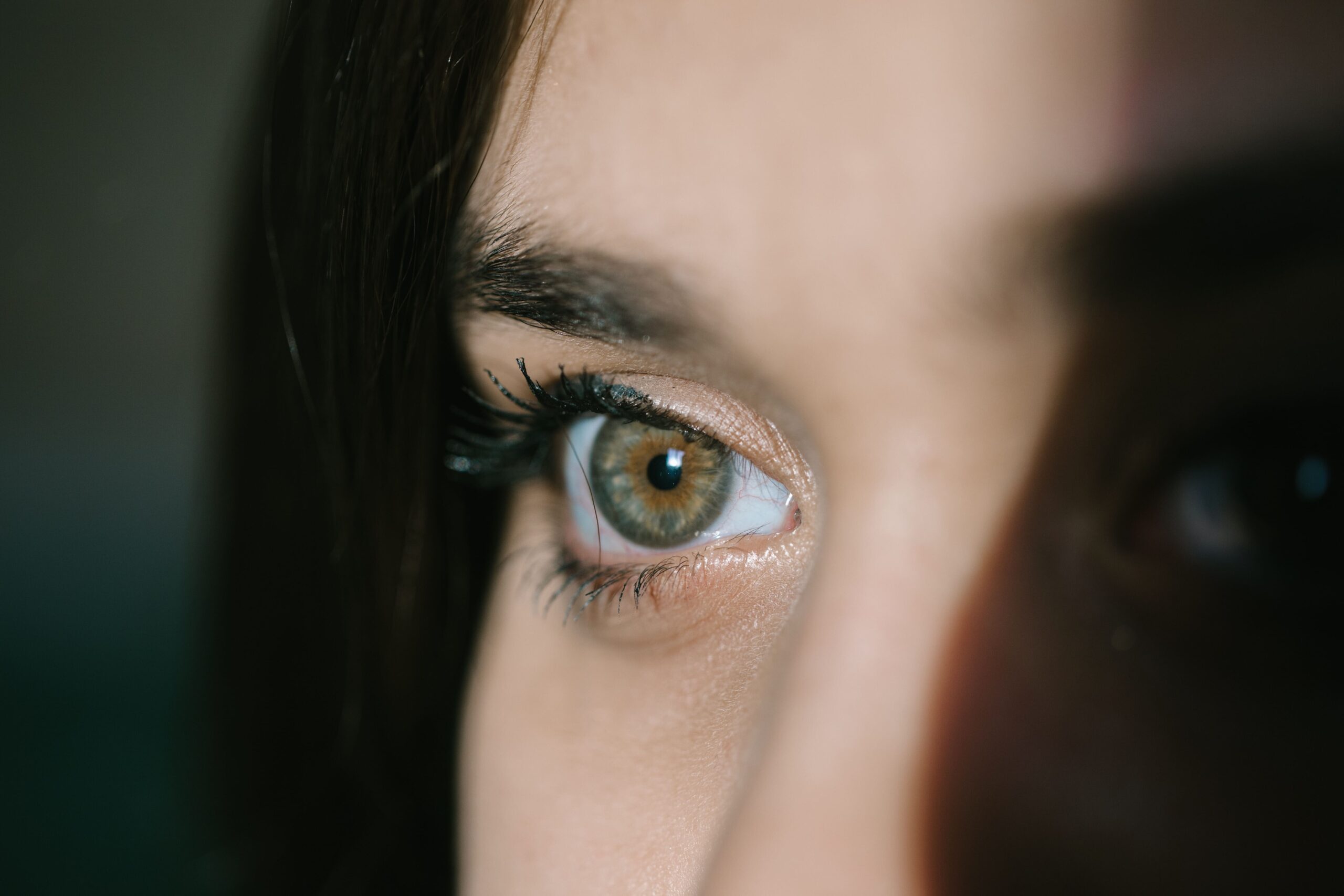 glaucoma