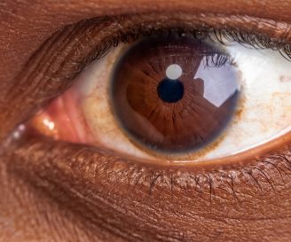 IAPB I CECITA CORNEALE