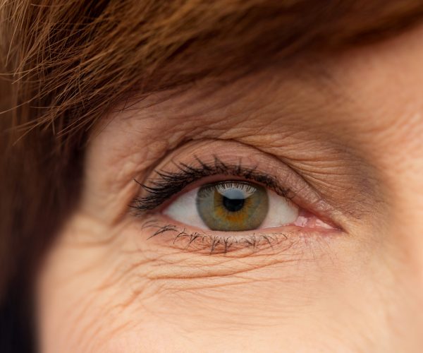 IAPB_OLD LADY _EYES