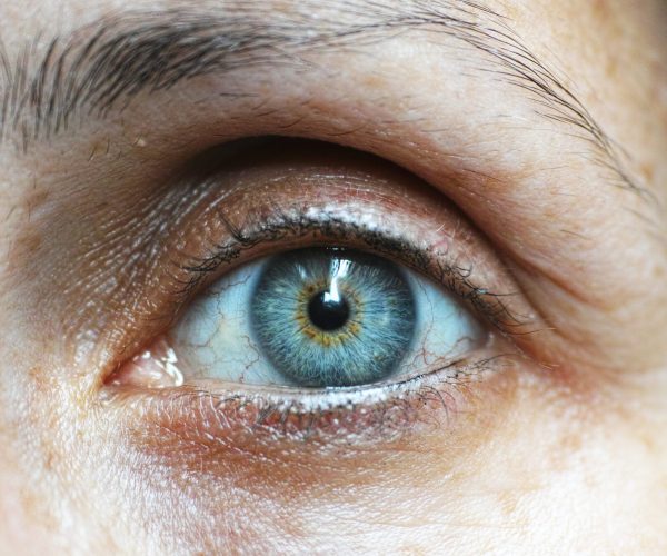 sintomi danni cornea