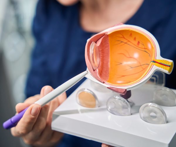 neuropatia ottica ischemica anteriore